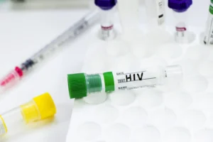 HIV Virus